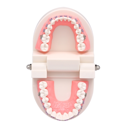 Dental Orthodontic Mallocclusion Model with Brackets Archwire Buccal Tube Teeth Model for Patient Communication Adult Teaching